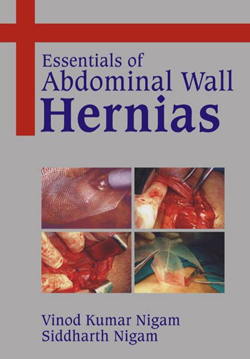 Essentials of Abdominal Wall Hernias