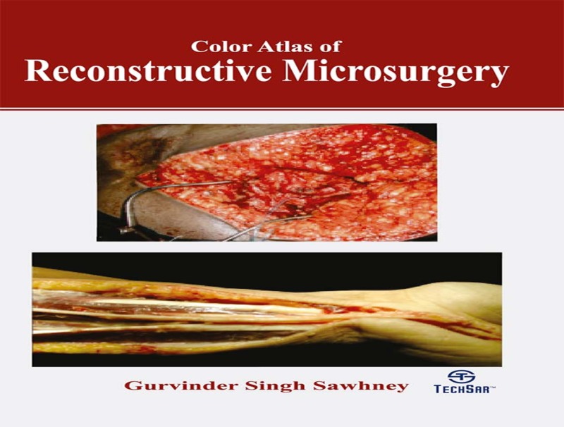 Color Atlas of Reconstructive Microsurgery